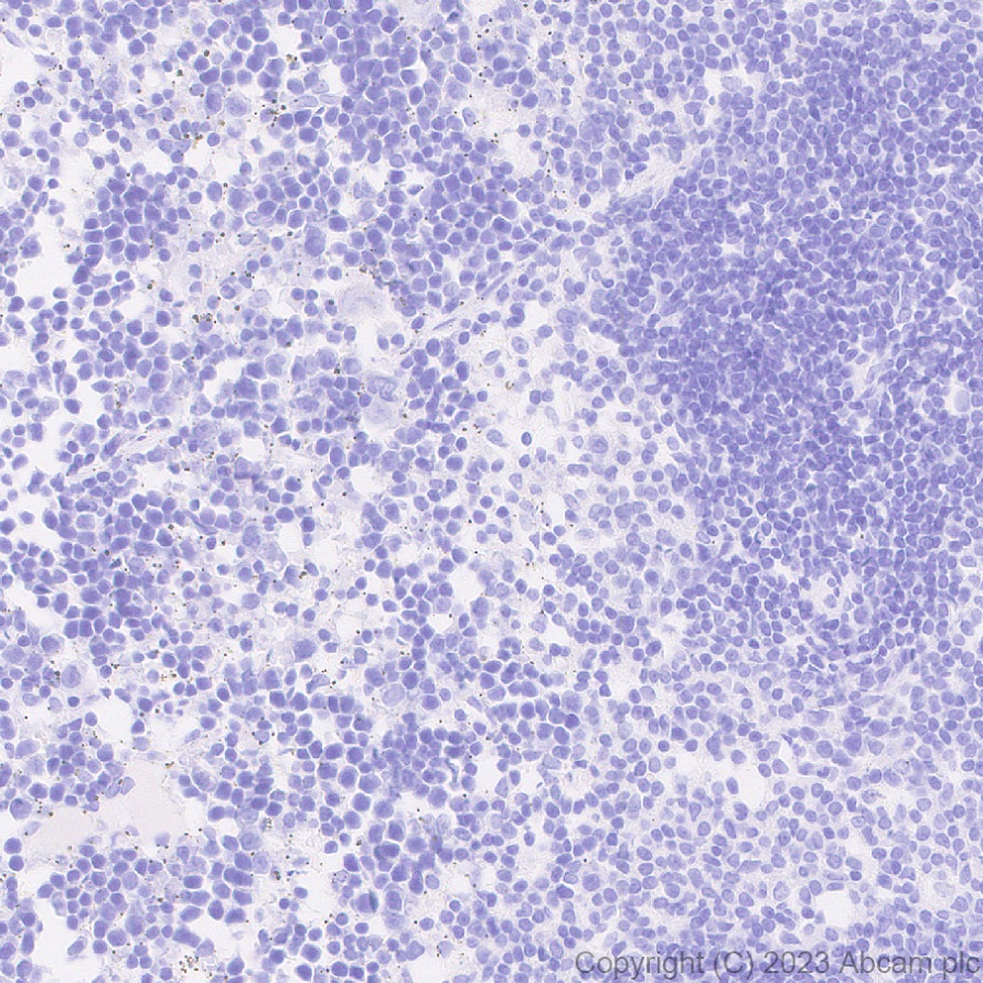 Immunohistochemistry (Formalin/PFA-fixed paraffin-embedded sections) - Anti-AMH antibody [EPR25835-27] - BSA and Azide free (ab313768), expandable thumbnail