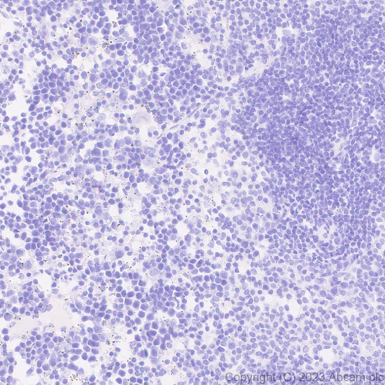 Immunohistochemistry (Formalin/PFA-fixed paraffin-embedded sections) - Anti-AMH antibody [EPR25835-27] - BSA and Azide free (AB313768)