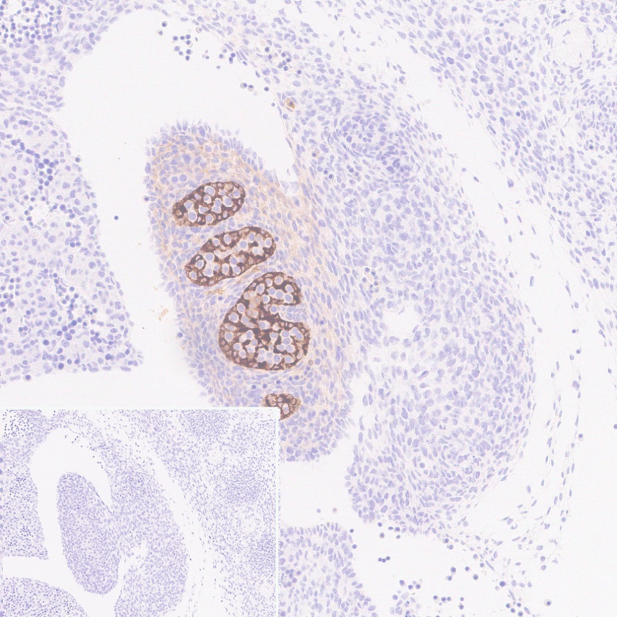 Immunohistochemistry (Formalin/PFA-fixed paraffin-embedded sections) - Anti-AMH antibody [EPR25835-27] - BSA and Azide free (AB313768), expandable thumbnail