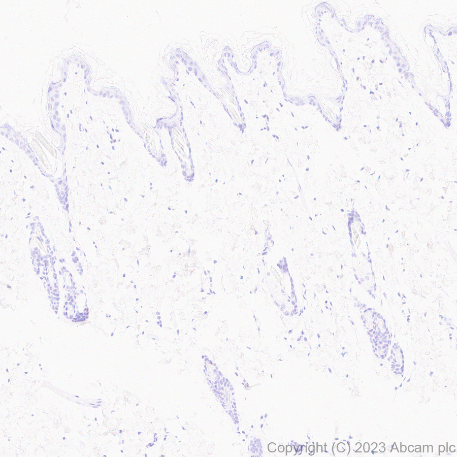 Immunohistochemistry (Formalin/PFA-fixed paraffin-embedded sections) - Anti-AMH antibody [EPR25835-27] - BSA and Azide free (AB313768), expandable thumbnail