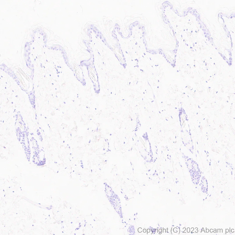 Immunohistochemistry (Formalin/PFA-fixed paraffin-embedded sections) - Anti-AMH antibody [EPR25835-27] - BSA and Azide free (AB313768)