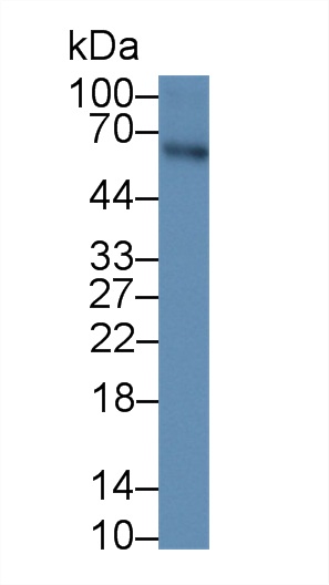 Western blot - Anti-AMH antibody [H1] (AB239491)