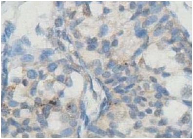 Immunohistochemistry (Formalin/PFA-fixed paraffin-embedded sections) - Anti-AMHR2 antibody (AB197148)