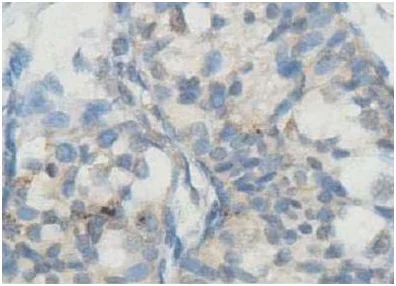 Immunohistochemistry (Formalin/PFA-fixed paraffin-embedded sections) - Anti-AMHR2 antibody (AB197148)