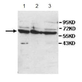 Western blot - Anti-AMHR2 antibody (AB197148)