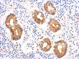Immunohistochemistry (Formalin/PFA-fixed paraffin-embedded sections) - Anti-AMID antibody - N-terminal (AB155326)
