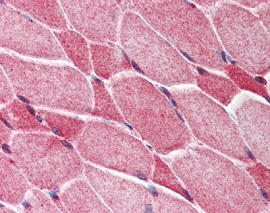 Immunohistochemistry (Formalin/PFA-fixed paraffin-embedded sections) - Anti-Amino-terminal enhancer of split/AES antibody (AB118881), expandable thumbnail