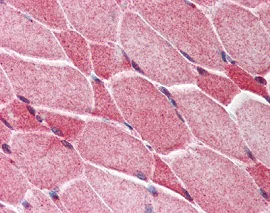 Immunohistochemistry (Formalin/PFA-fixed paraffin-embedded sections) - Anti-Amino-terminal enhancer of split/AES antibody (AB118881)