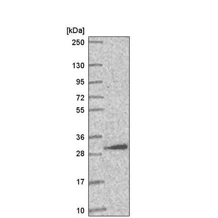 Western blot - Anti-AMMECR1L antibody (AB220837)