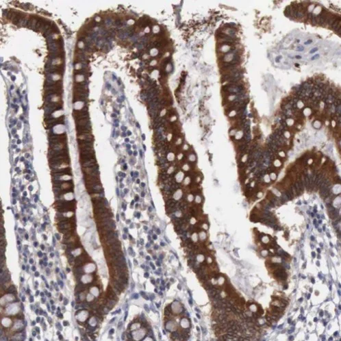 Immunohistochemistry (Formalin/PFA-fixed paraffin-embedded sections) - Anti-AMN antibody (AB224213)