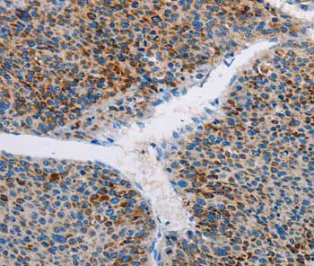 Immunohistochemistry (Formalin/PFA-fixed paraffin-embedded sections) - Anti-AMOTL2 antibody (AB197818)