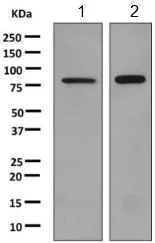 Western blot - Anti-AMPD1 antibody [EPR7495] (AB154814)