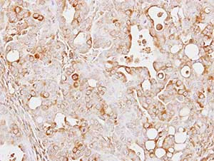 Immunohistochemistry (Formalin/PFA-fixed paraffin-embedded sections) - Anti-AMPD2 antibody (AB137598)