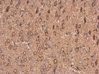 Immunohistochemistry (Formalin/PFA-fixed paraffin-embedded sections) - Anti-AMPD2 antibody (AB137598)