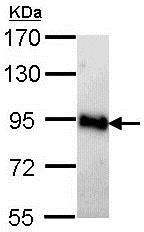 Western blot - Anti-AMPD2 antibody (AB137598), expandable thumbnail