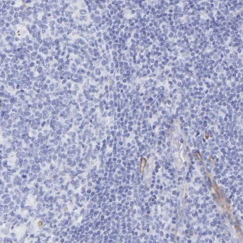 Immunohistochemistry (Formalin/PFA-fixed paraffin-embedded sections) - Anti-Amphiphysin antibody (AB244375)