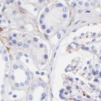 Immunohistochemistry (Formalin/PFA-fixed paraffin-embedded sections) - Anti-Amphiphysin antibody (AB244375)