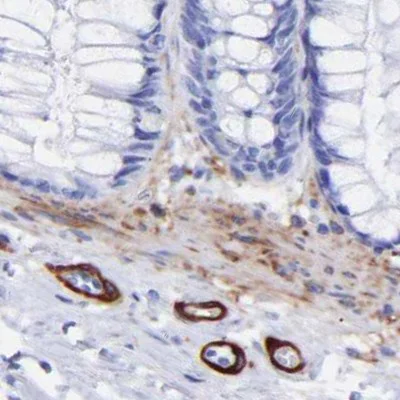 Immunohistochemistry (Formalin/PFA-fixed paraffin-embedded sections) - Anti-Amphiphysin antibody (AB244375)
