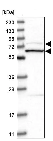 Western blot - Anti-Amphiphysin antibody (AB244375)