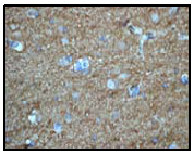 Immunohistochemistry (Formalin/PFA-fixed paraffin-embedded sections) - Anti-Amphiphysin antibody [EP2060Y] (AB52646)