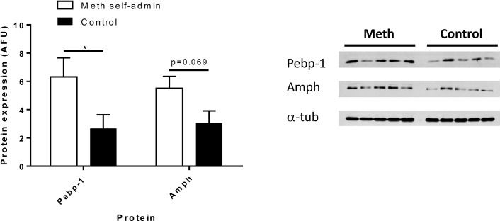Western blot - Anti-Amphiphysin antibody [EP2060Y] (AB52646)