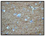 Immunohistochemistry (Formalin/PFA-fixed paraffin-embedded sections) - Anti-Amphiphysin antibody [EP2060Y] - BSA and Azide free (AB247329)