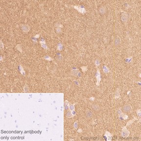 Immunohistochemistry (Formalin/PFA-fixed paraffin-embedded sections) - Anti-Amphiphysin antibody [EP2061Y] (AB76124)