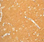 Immunohistochemistry (Formalin/PFA-fixed paraffin-embedded sections) - Anti-Amphiphysin antibody [EP2061Y] - BSA and Azide free (AB284743)