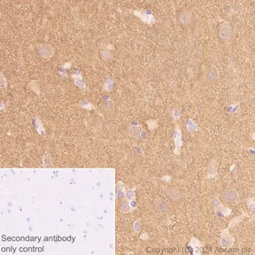 Immunohistochemistry (Formalin/PFA-fixed paraffin-embedded sections) - Anti-Amphiphysin antibody [EP2061Y] - BSA and Azide free (AB284743)