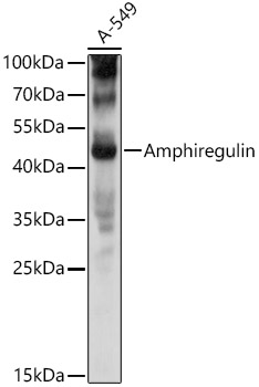 Western blot - Anti-Amphiregulin antibody (AB180722), expandable thumbnail