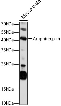 Western blot - Anti-Amphiregulin antibody (AB180722), expandable thumbnail