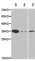 Western blot - Anti-Amphiregulin antibody (AB180722), expandable thumbnail