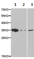 Western blot - Anti-Amphiregulin antibody (AB180722)