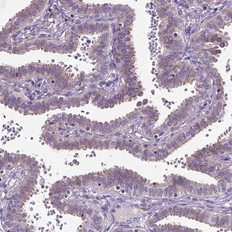 Immunohistochemistry (Formalin/PFA-fixed paraffin-embedded sections) - Anti-Amphiregulin antibody (AB224350)