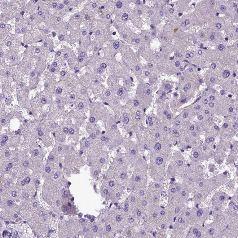 Immunohistochemistry (Formalin/PFA-fixed paraffin-embedded sections) - Anti-Amphiregulin antibody (AB224350)