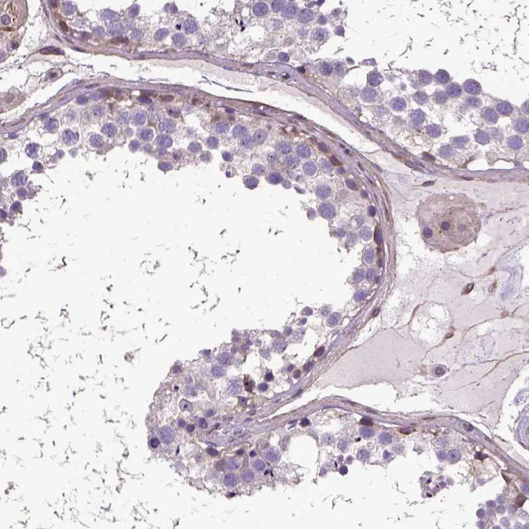 Immunohistochemistry (Formalin/PFA-fixed paraffin-embedded sections) - Anti-Amphiregulin antibody (AB224350)