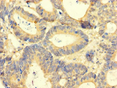 Immunohistochemistry (Formalin/PFA-fixed paraffin-embedded sections) - Anti-Amphiregulin antibody (AB234750)