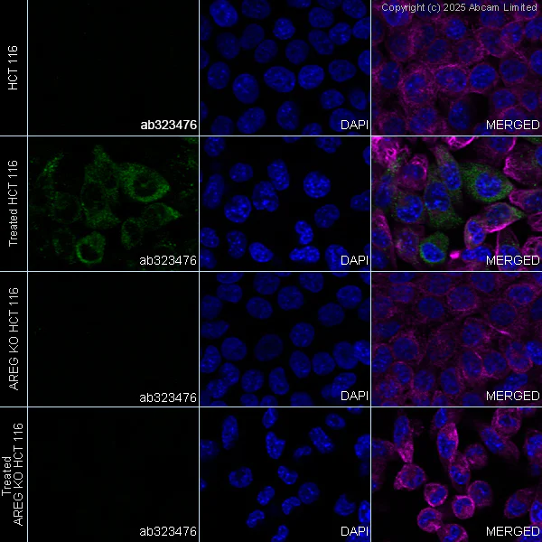Immunocytochemistry/ Immunofluorescence - Anti-Amphiregulin antibody [EPR28751-564] (AB323476)