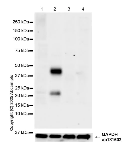 Western blot - Anti-Amphiregulin antibody [EPR28751-564] (AB323476)