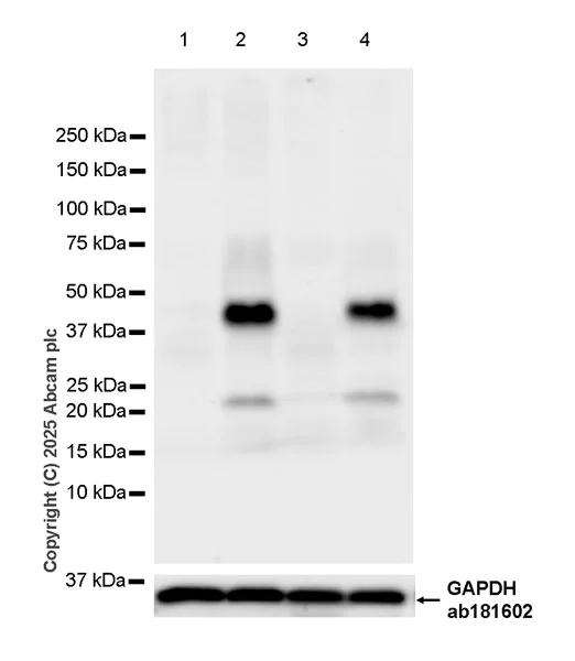 Western blot - Anti-Amphiregulin antibody [EPR28751-564] (AB323476)