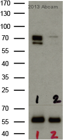 Western blot - Anti-AMPK alpha 1 + AMPK alpha 2 antibody [34.2] (AB80039), expandable thumbnail