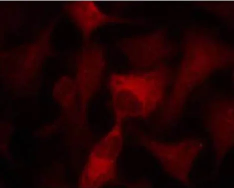 Immunocytochemistry/ Immunofluorescence - Anti-AMPK alpha 1 + AMPK alpha 2 antibody (AB131512)