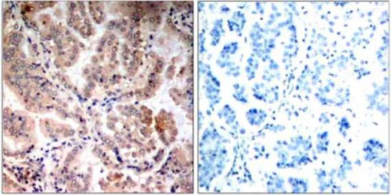 Immunohistochemistry (Formalin/PFA-fixed paraffin-embedded sections) - Anti-AMPK alpha 1 + AMPK alpha 2 antibody (AB131512)