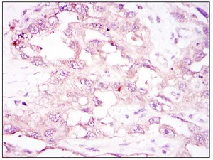 Immunohistochemistry (Formalin/PFA-fixed paraffin-embedded sections) - Anti-AMPK alpha 1 antibody [2B7] (AB110036)