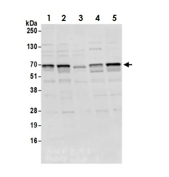 Western blot - Anti-AMPK alpha 1 antibody (AB3759)