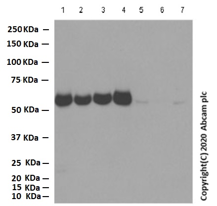 Western blot - Anti-AMPK alpha 1 antibody [Y365] (ab32047), expandable thumbnail