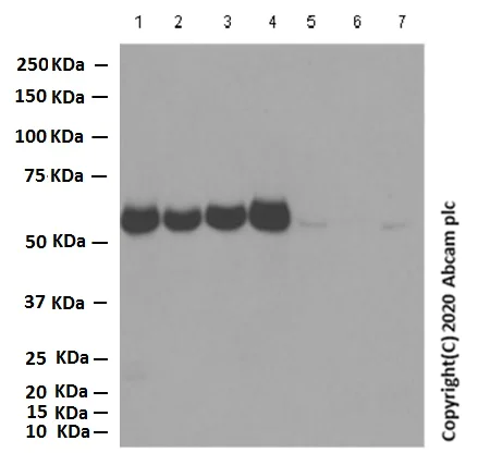 Western blot - Anti-AMPK alpha 1 antibody [Y365] (AB32047)