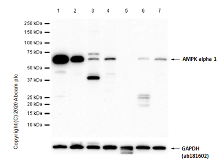 Western blot - Anti-AMPK alpha 1 antibody [Y365] (AB32047)
