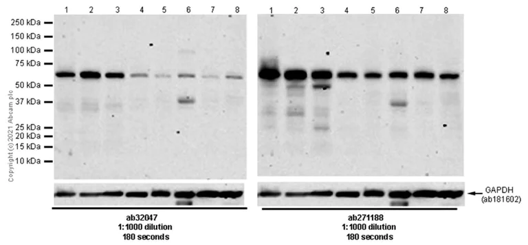 Western blot - Anti-AMPK alpha 1 antibody [Y365] (AB32047)