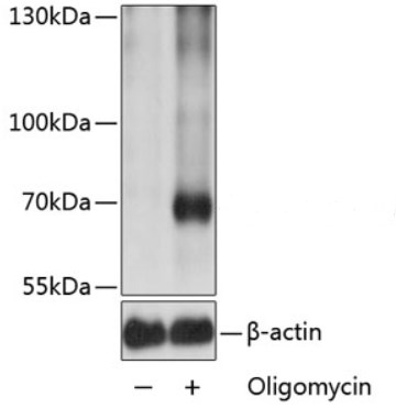 Western blot - Anti-AMPK alpha 1 (phospho T183) + AMPK alpha 2 (phospho T172) antibody (AB194920)
